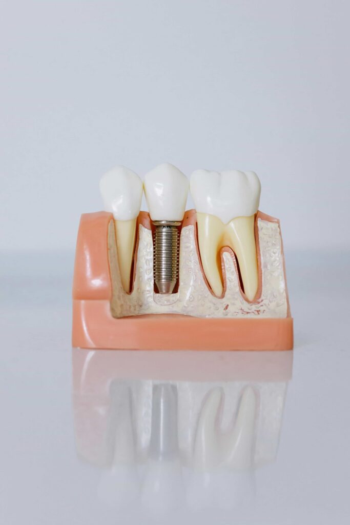 root canal tooth model