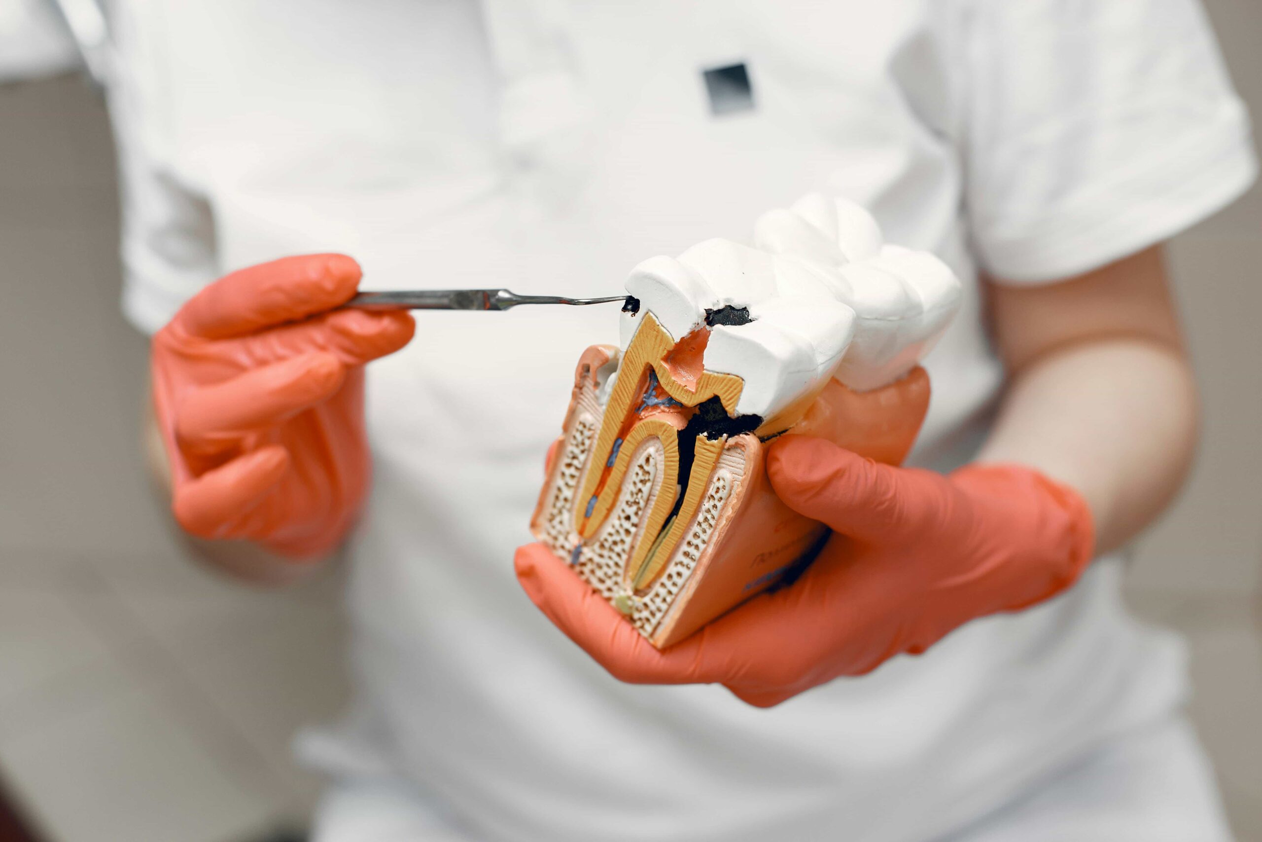 orthodontist showing model with root canal