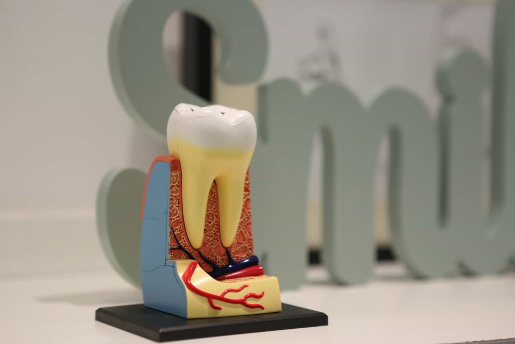 model of a tooth in need of root canal