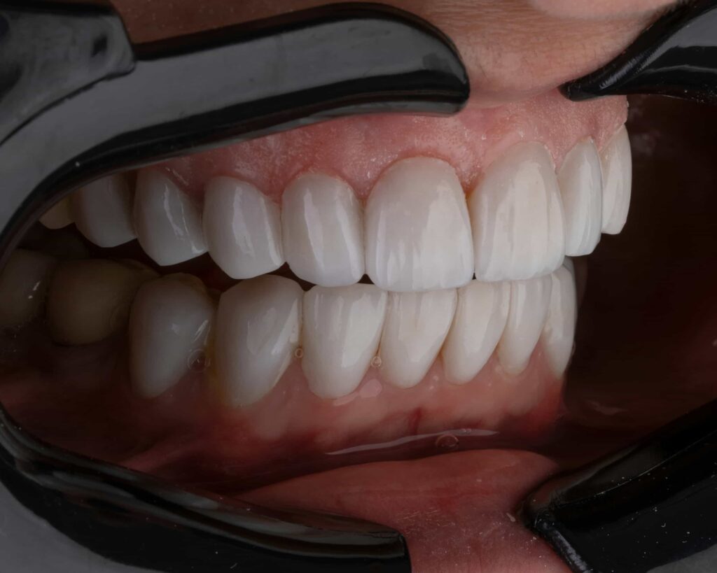 teeth