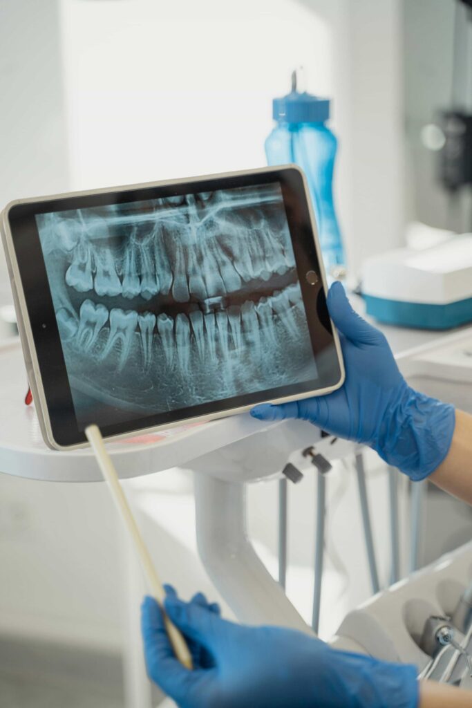 dental xray