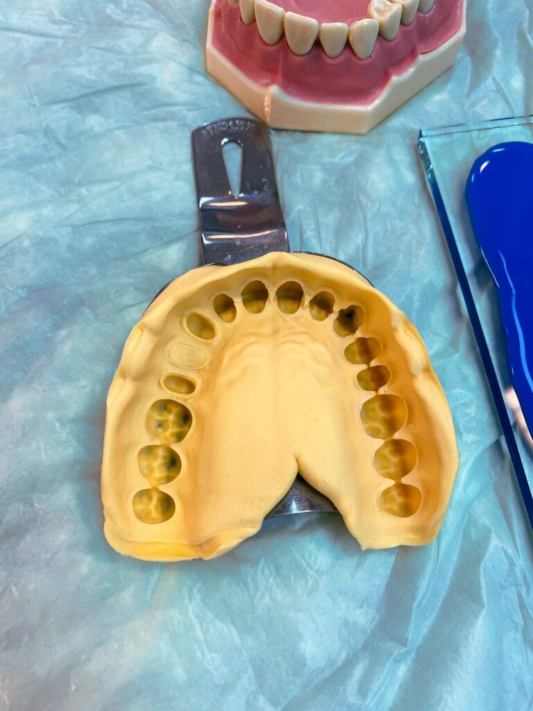 dental mold